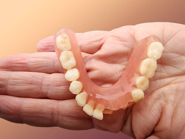 flexible nylon denture on male hand. Removable dentures flexible, devoid of nylon, hypoallergenic exempt from monomer