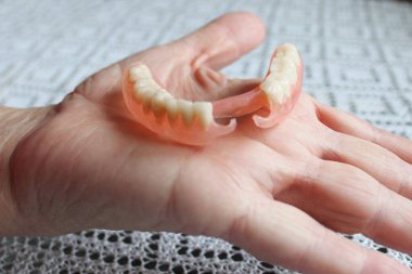 flexible nylon denture on male hand. Removable dentures flexible, devoid of nylon, hypoallergenic exempt from monomer clipart