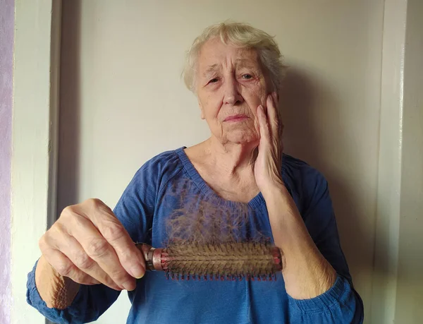 Mulher Sênior Com Problema Perda Cabelo Fundo Casa — Fotografia de Stock