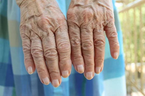 Senior woman's hand at home. Aging process