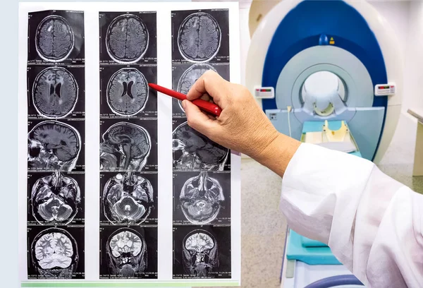 The magnetic resonance image or MRI of the male brain and hand of doctor
