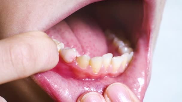 Детский молочный зуб с языком — стоковое видео