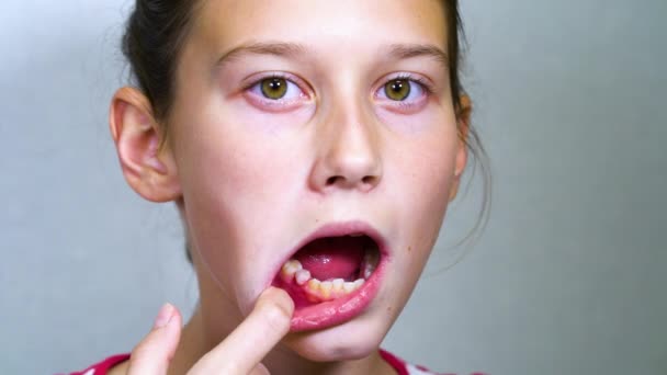 Девушка трясущая молочный зуб языком — стоковое видео