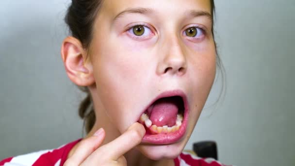Девушка пытается удалить молочный зуб языком — стоковое видео