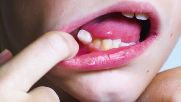 Child removing baby tooth with tongue — Stock Video