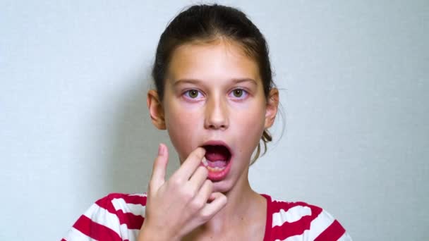 Girl opening mouth and removing milk tooth with tongue — Stock Video