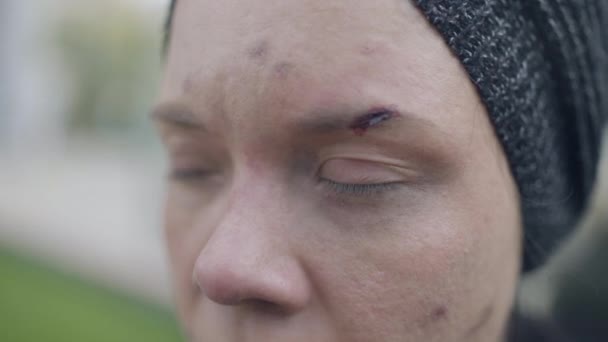 Schwindelgeplagte Frau mit Wunden im Gesicht, Drogenmissbrauch, Drogenrausch, Gesundheit — Stockvideo