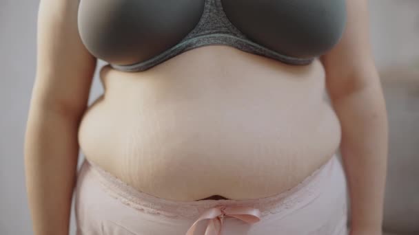 肥満女性の腹に医師のマークを作ります 形成外科 脂肪除去 美しさ — ストック動画