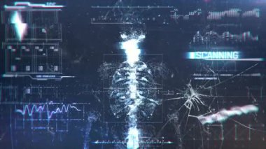 Ekranda insan bedeni taraması, hacklenen yazılım, teknik sorun, virüs. Hastanın vücut taramasını gösteren tıbbi yazılım