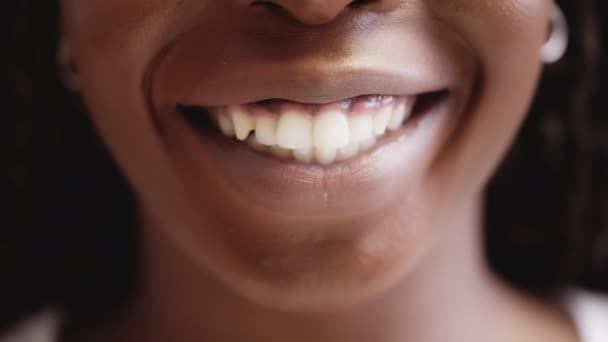 Mulher Africana Bonita Sorrindo Dentes Saudáveis Cuidados Dentários Sistema Clareamento — Vídeo de Stock