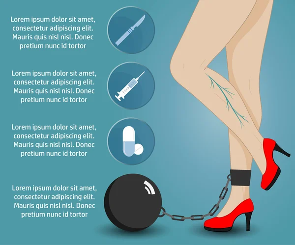 Varicose infografis medis - Stok Vektor