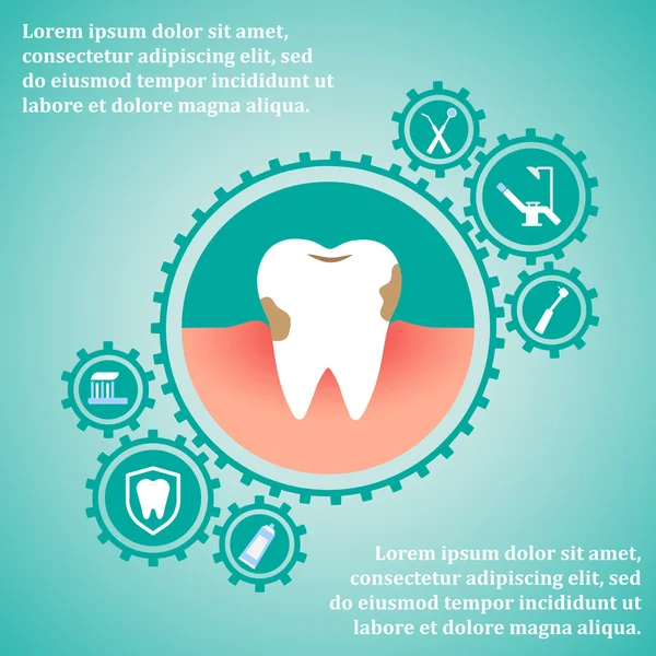 Modelo dentário para infográfico — Vetor de Stock