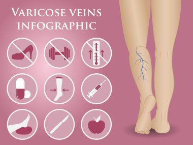 phlebology vektör infographics