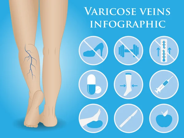 Infografías vectoriales flebología — Vector de stock