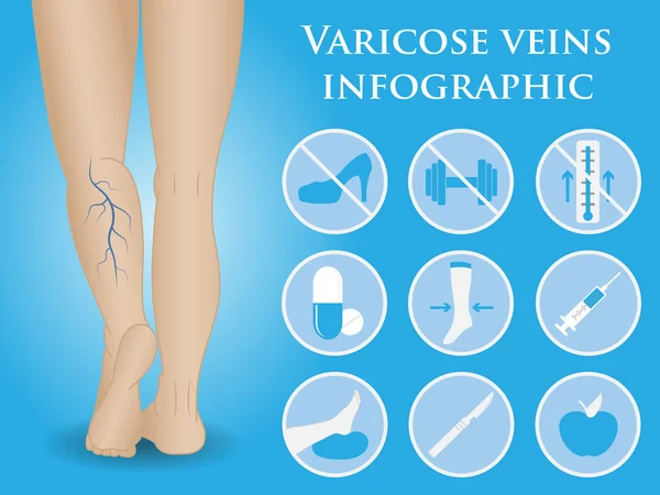 Infográficos vetoriais de flebologia —  Vetores de Stock