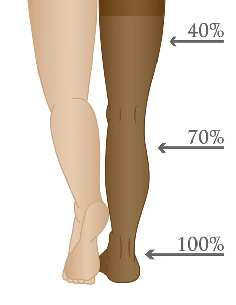 医疗压缩裤袜 — 图库矢量图片