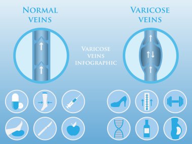 phlebology vektör infographics