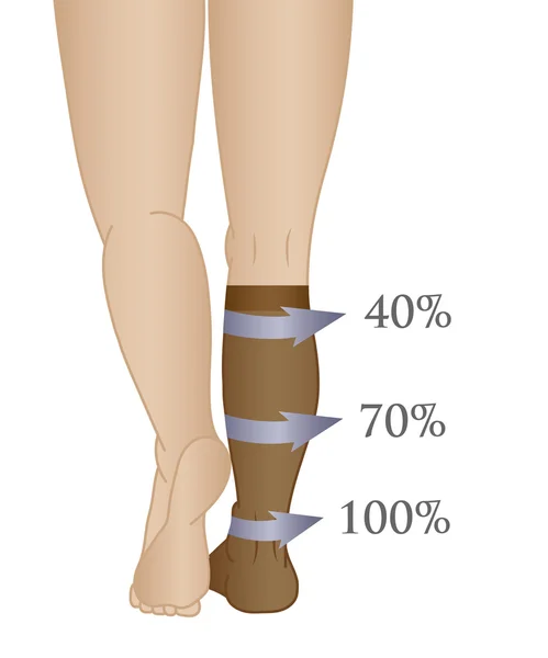 Ιατρική συμπίεσης κάλτσες και καλσόν — Διανυσματικό Αρχείο