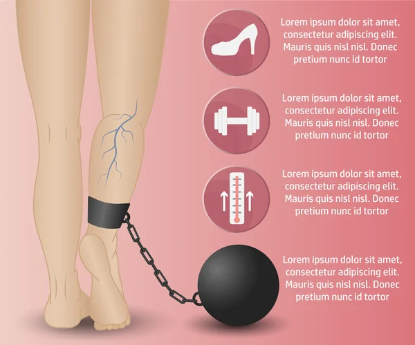 Varicose Infografica flebologia — Vettoriale Stock