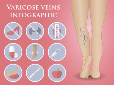 phlebology vektör Infographic