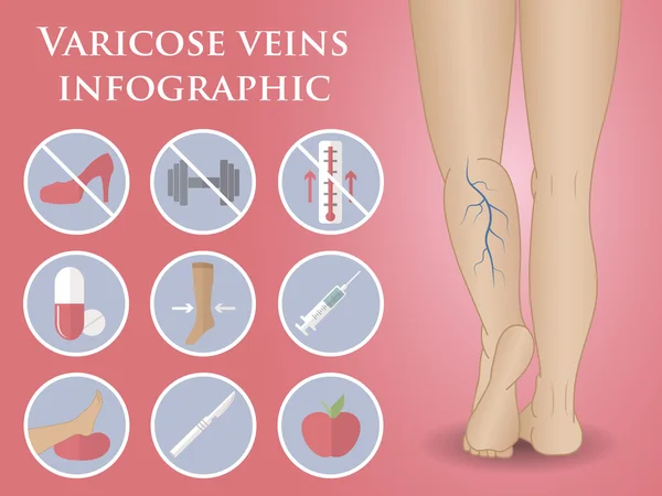 Phlebology 벡터 infographic — 스톡 벡터