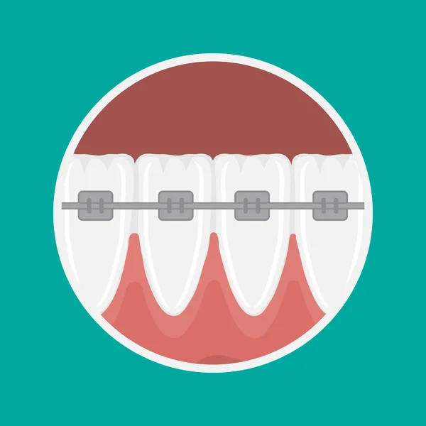 Icône vectorielle incisives dents — Image vectorielle