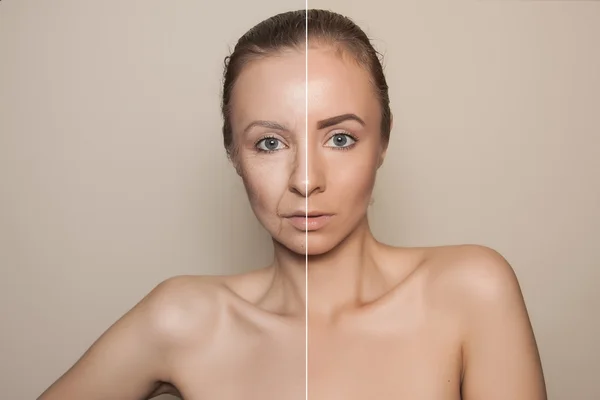 Sebelum dan sesudah prosedur kecantikan — Stok Foto