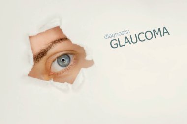 Kadının gözü kağıttaki yırtık deliğe bakıyor, sol tarafta Glaucoma kelimesi var. Göz hastalığı konsepti şablonu. 