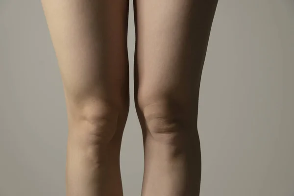 Rodillas Con Sobrepeso Relámpagos Contraste Las Caderas Mujer Primer Plano —  Fotos de Stock