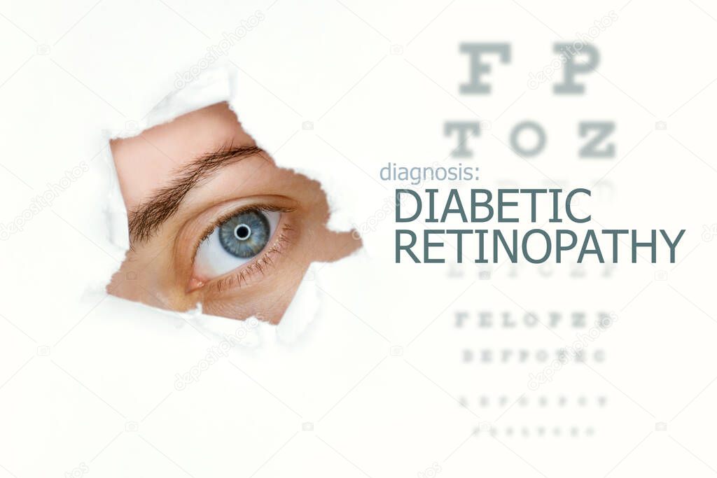 Woman`s eye looking trough teared hole in paper, eye test with words Diabetic Retinopathy on right. Eye disease concept template. White background.