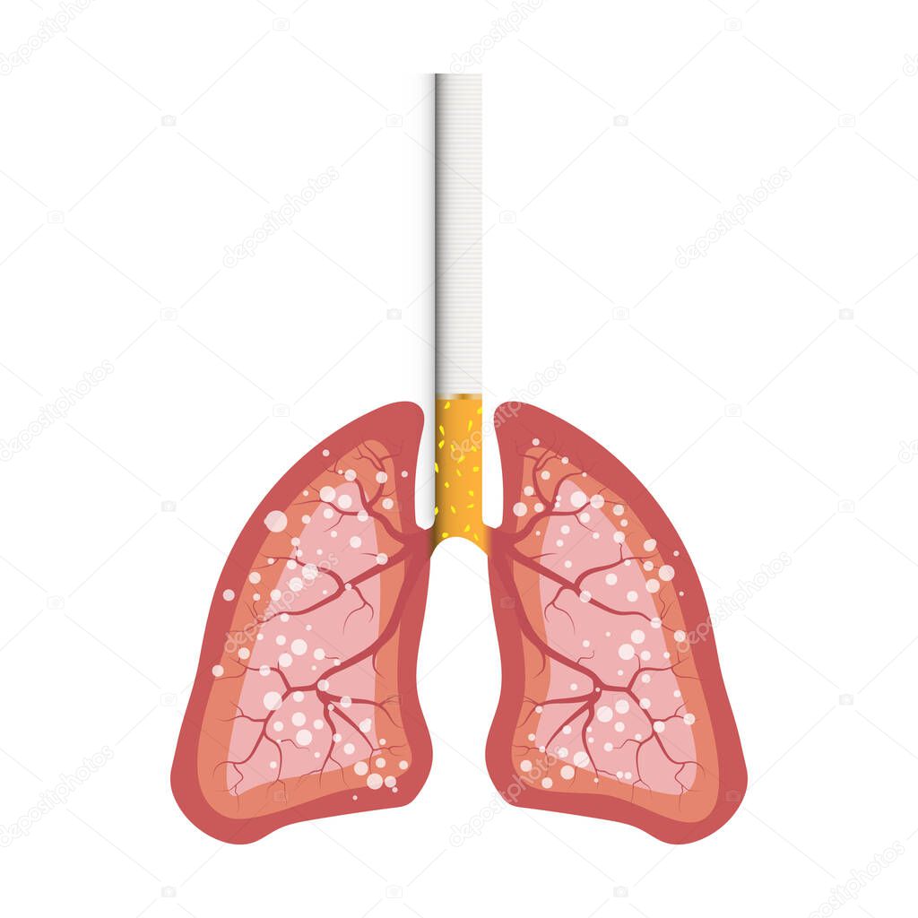 Illustration Smokers lungs, cancer from cigarettes in detail, a symbol of nicotine addiction. Vector illustration, with white background. Stop smoking concept.