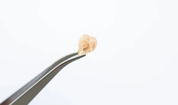 Cımbız Kalp Şeklindeki Kırık Yirmilik Dişini Tutan Beyaz Arka Planda — Stok fotoğraf