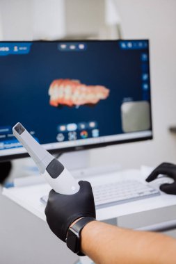 Üç boyutlu diş modelli intraoral tarayıcı dijital diş muayenesi sırasında monitörde. Yüksek kalite fotoğraf