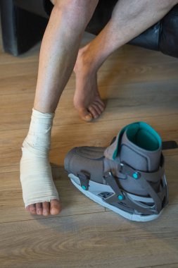 Yaralı ayak ve ortopedik botun yanında bandaj var. İyileşme süreci devam ediyor.