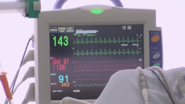 Überwachung der künstlichen Lungenbeatmung auf dem Monitor, der den Pulsstatus der Patienten anzeigt — Stockvideo