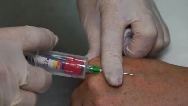 혈관을 감싸고 있는 혈액 샘플을 채취하는 모습 — 비디오