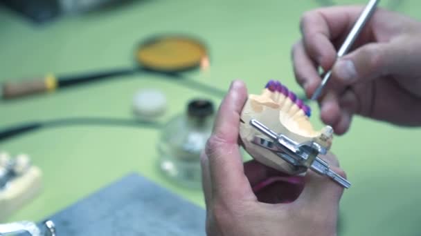 Fabricación de prótesis dentales, el técnico dental elimina el exceso de cera de la pieza de trabajo . — Vídeos de Stock