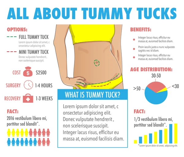 Tummy tuck, abdominoplasty infographic — Stock Vector