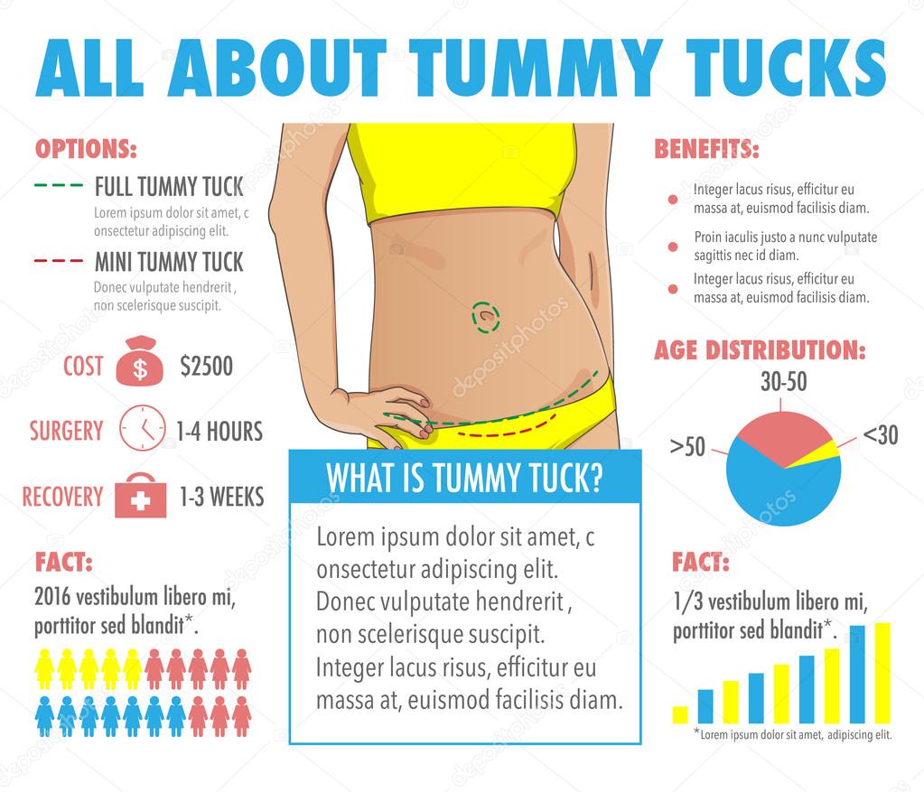 Tummy tuck, abdominoplasty infographic