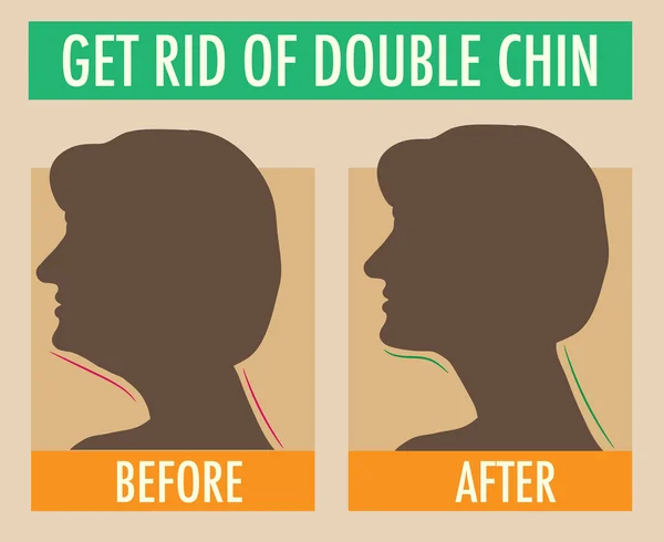 Reduce double chin. Get rid of face and neck fat concept. — Stock Vector