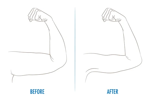 Bíceps feminino antes e depois do esporte. Braços mostrando progresso afte —  Vetores de Stock