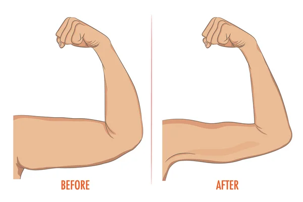 Bíceps feminino antes e depois do esporte. Braços mostrando progresso afte —  Vetores de Stock