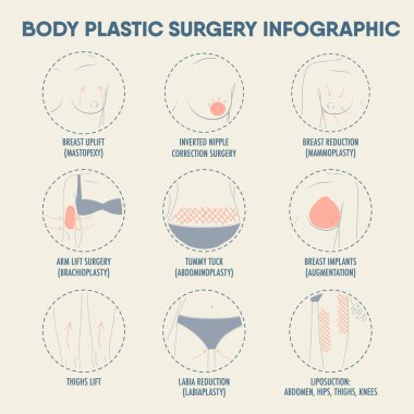 Body plastic surgery infographic for posters and web. Breast uplift, reduction, implants, thighs lift, liposuction, tummy tuck, arm lift surgery, diastasis. Beauty care concept. Vector icons clipart