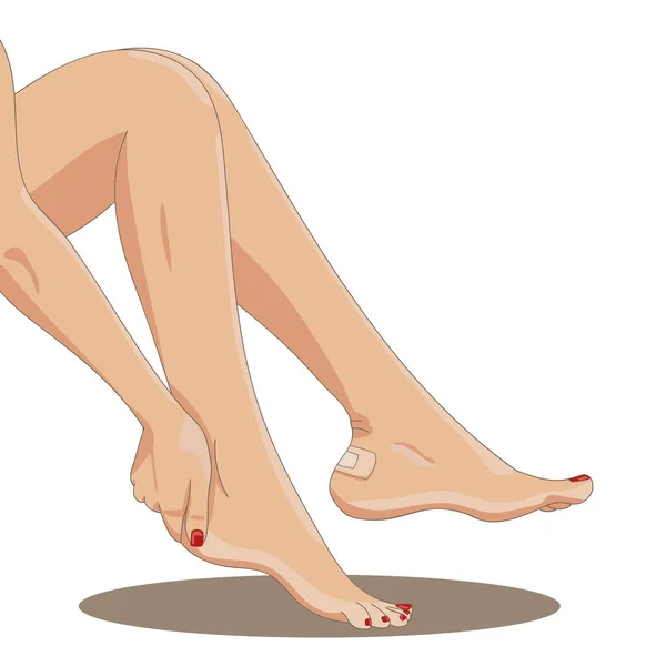 Patas Femeninas Desnudas Con Yeso Ampolloso Aplicado Talón Vista Lateral — Vector de stock