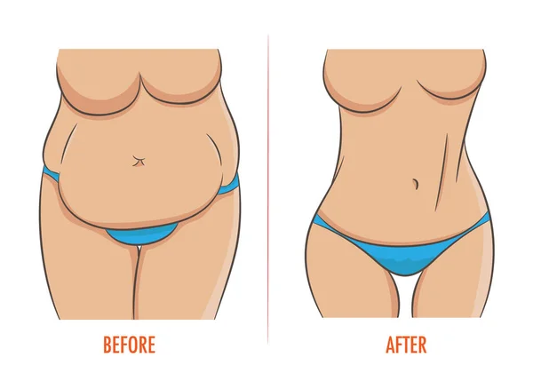 Kalın ve ince, aşırı kilolu problem kavramı. Gövdesinin bir kısmı yağlı ve yağsız karın ve kalçalarla dolu. Diyet öncesi ve sonrası mide, fitness veya liposuction. Kadın göbeğinin vektör çizimi.