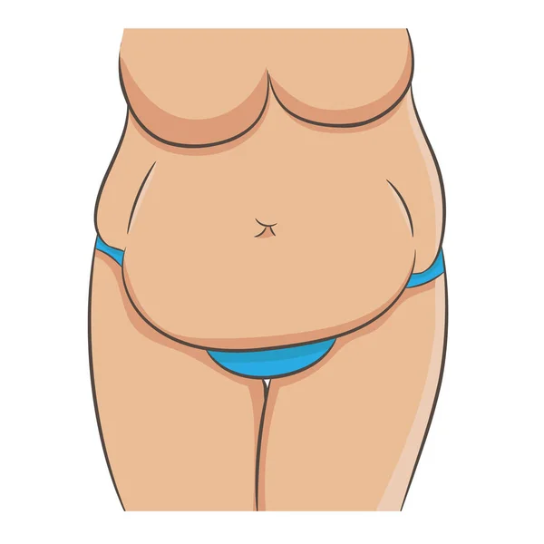 Fettleibigkeit Und Ungesunde Ernährung Ein Teil Des Weiblichen Oberkörpers Mit — Stockvektor