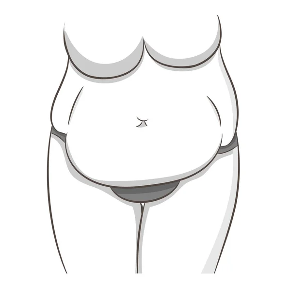 肥胖和不健康的饮食问题概念 部分女性躯干 腹部和臀部丰满 饮食前 健康或吸脂前的肿瘤 体重超标妇女腹部的病媒说明 — 图库矢量图片
