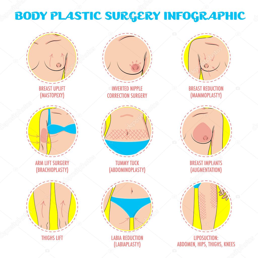 Cosmetic plastic surgery vector icons for infographic, posters and brochures. Rhinoplasty, face lifting, blepharoplasty, eye and lip surgery, hair transplant, cheek implants. Beauty care concept.