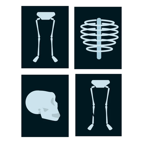 Рентгенівська людської голови — стоковий вектор