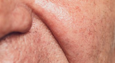 Yaşlıların cilt ve yüz hatlarına yakın çekim.